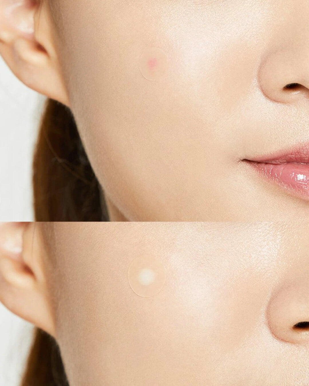 COSRX Acne Pimple Master Patch (24 Patches) — gallery image 2