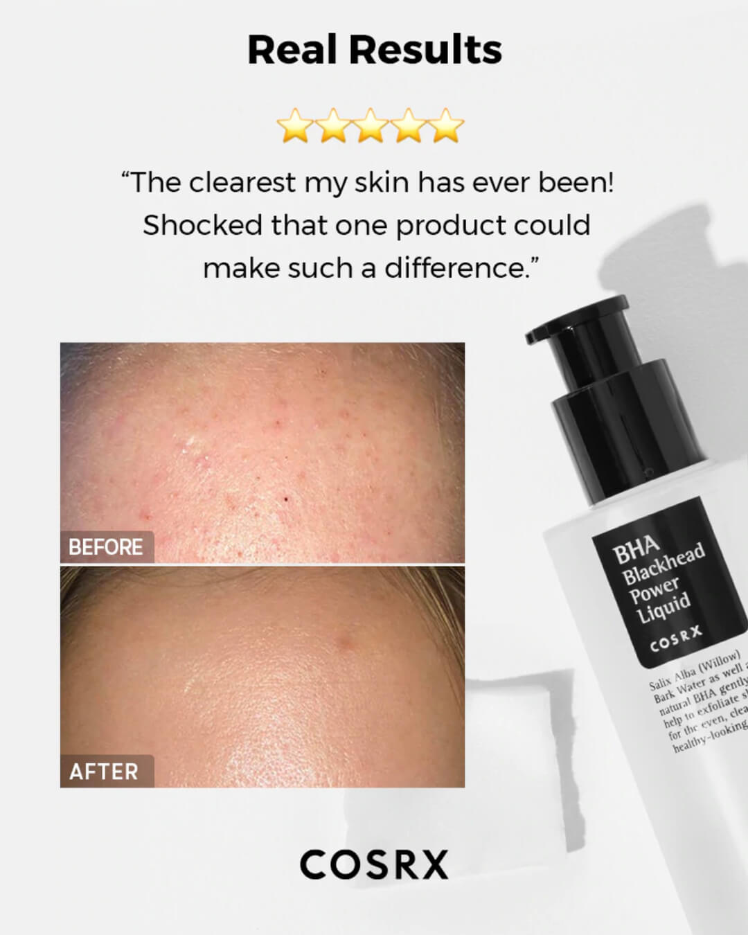 COSRX BHA Blackhead Power Liquid 100ml — gallery image 7