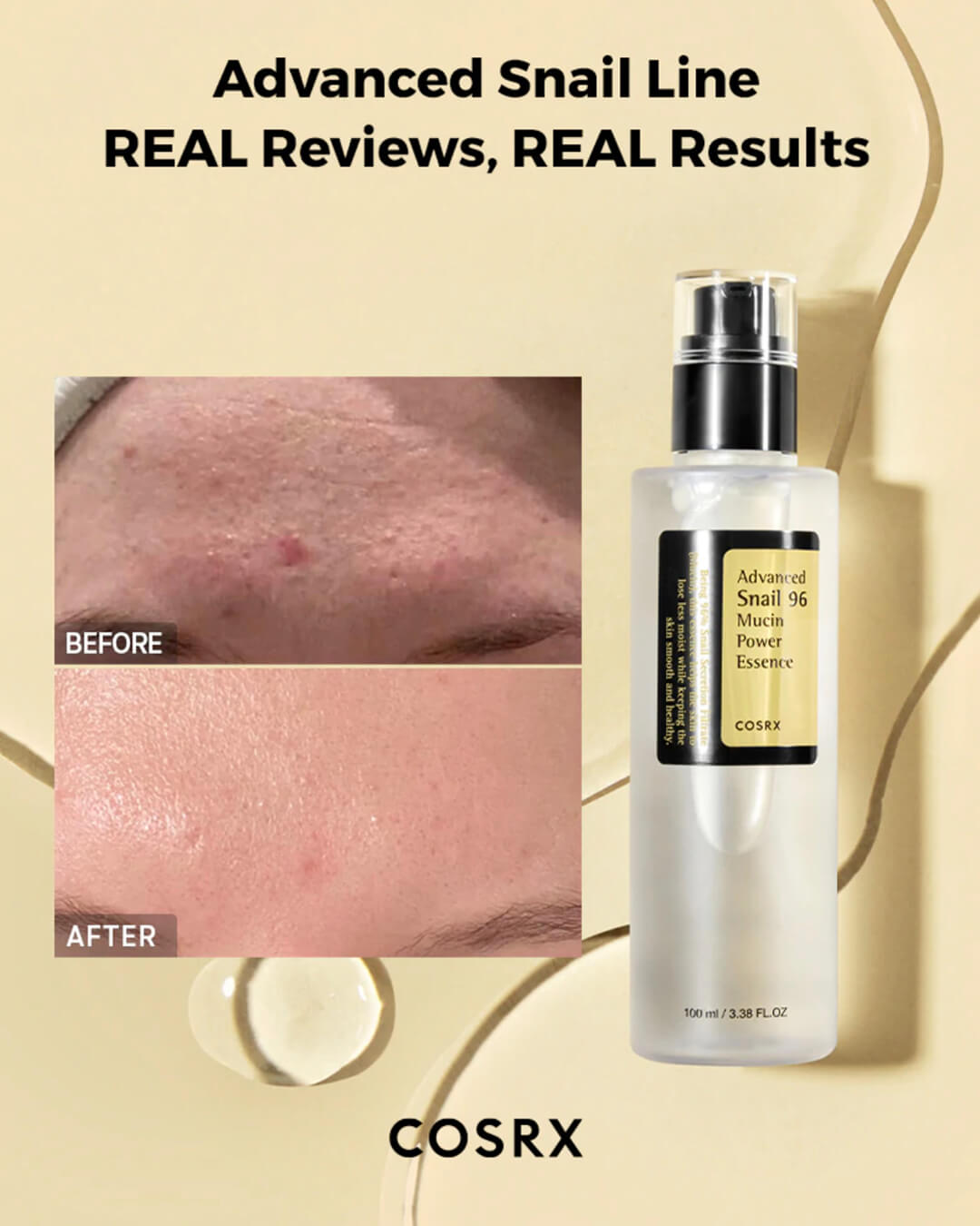 COSRX Advanced Snail 96 Mucin Power Essence 100ml — gallery image 5